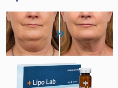 Bộ nạp nâng bằng thép không gỉ GMP 316 CIP Đế cắm kín có thể làm sạch cho phòng thí nghiệm Sản xuất R&D giường chất lỏng