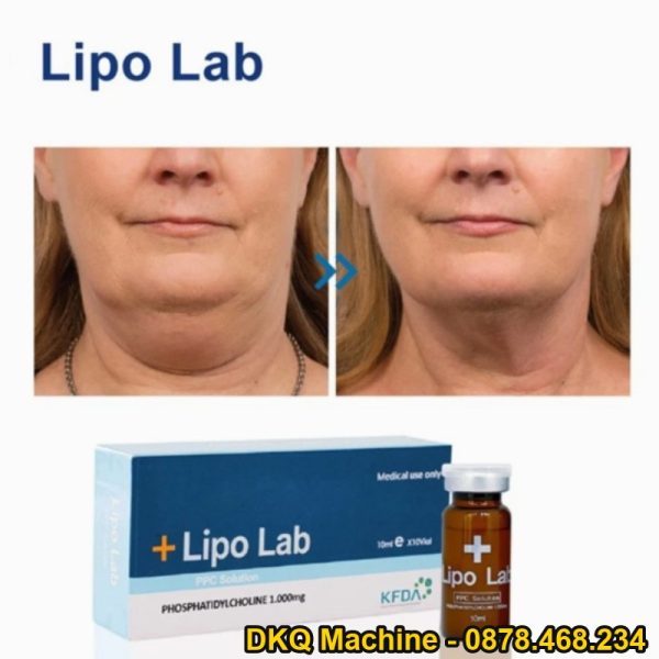 Bộ nạp nâng bằng thép không gỉ GMP 316 CIP Đế cắm kín có thể làm sạch cho phòng thí nghiệm Sản xuất R&D giường chất lỏng
